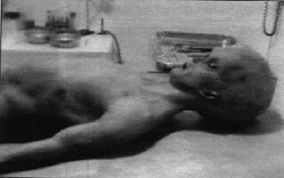 Roswell Alien Autopsy